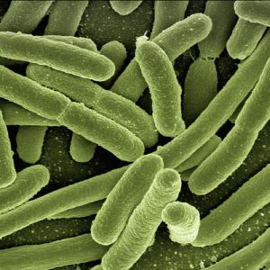 Local authority sentenced after member of public contracts Legionnaires’ Disease